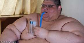 Homem mais gordo do mundo passará por nova cirurgia de redução