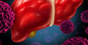 Foto: (wildpixel/itock)