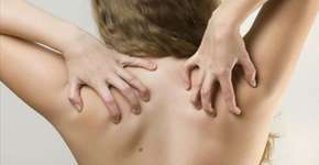 Três dicas para evitar espinhas nas costas