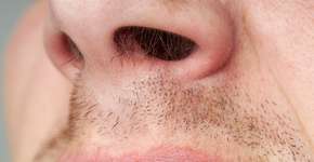 Foto: (Andrii Atanov/istock)