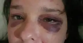 Mulher é espancada por apoiadores de Bolsonaro em Recife