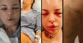 Foto: (Imagem sem texto alternativo disponivel ID [998015])