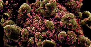 Foto: (Imagem sem texto alternativo disponivel ID [2025510])