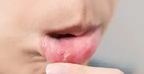 Foto: (Imagem sem texto alternativo disponivel ID [2456467])