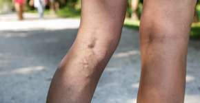 Foto: (zlikovec/ddepositphotos)