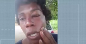 MG: Acusado de roubo, jovem negro diz que foi agredido em supermercado