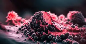 Quase 200 substâncias ligadas ao câncer de mama são achadas em embalagens