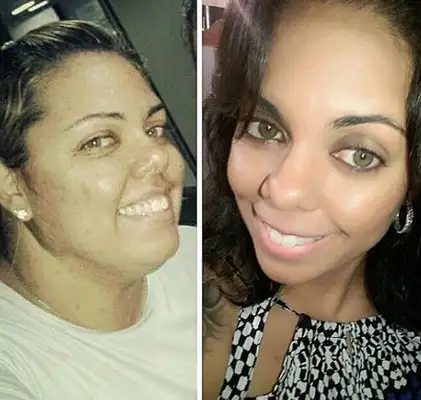 A ex-obesa mudou radicalmente de vida