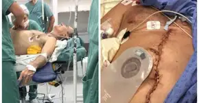 Vídeo da Record com médico cria fake news de câncer de Bolsonaro
