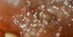 Foto: (BobYue/istock)