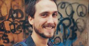 Igor Angelkorte exibe manchas de vitiligo e dá show de aceitação