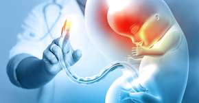 Foto: (iStock/Mohammed Haneefa Nizamudeen)