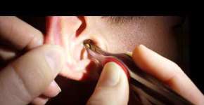 Foto: (Imagem sem texto alternativo disponivel ID [901089])