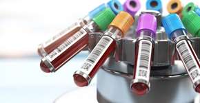 Foto: (iStock/Bet_Noire)