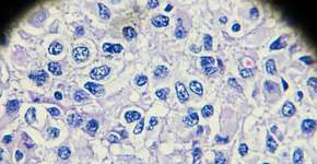 Foto: (jxfzsy/istock)