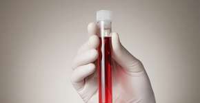 Foto: (Vonschonertagen/DepositPhotos)