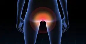 Sangramento revelou câncer anal ligado ao HPV