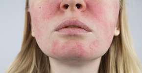 Foto: (iSTock/Alona Siniehina)