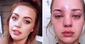 O perigo de usar maquiagem emprestada