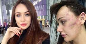 Modelo sérvia acusa namorado turco de agredi-la por 7h