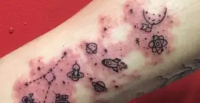 22 tatuagens criativas feitas com marcas de nascença