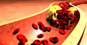 Este superalimento reduz o colesterol e aumenta expectativa de vida