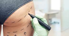 Foto: (ronstik/istock)