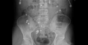 Abertura da exposição “Corpos estranhos”