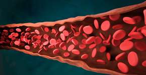 Foto: (Grigorii Yalukov/istock)