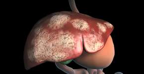 Foto: (Ozgu Arslan/istock)