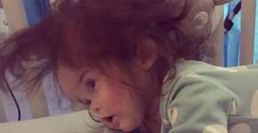 Ela usa peruca? Esta é Millie, a bebê de 11 meses e muito cabelo