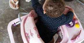 Bebê morre após mordida de pit bull que era da família