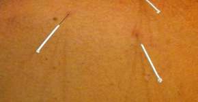 Foto: (Imagem sem texto alternativo disponivel ID [279279])