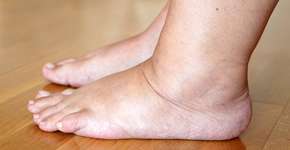 Foto: (iStock/Ruslana Chub)