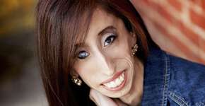 Chamada de a mulher mais feia do mundo, conheça Lizzie Velasquez