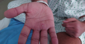 Foto: (reprodução/twitter/Harun Tulunay)