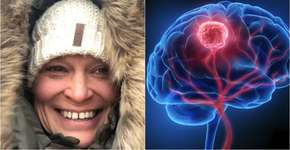 Foto: (Tumor Brain Research/peterschreiber.media/istock)