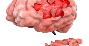 Foto: (alexlmx/DepositPhotos)