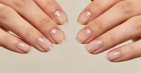 Foto: (Imagem sem texto alternativo disponivel ID [2714136])