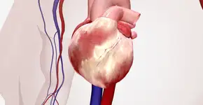 Novo estudo aponta bebida que leva à doença cardíaca; veja qual