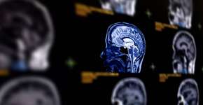 Foto: (iStock/mr.suphachai praserdumrongchai)