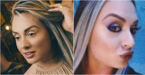 Juju Salimeni aplica botox e exibe resultado na web