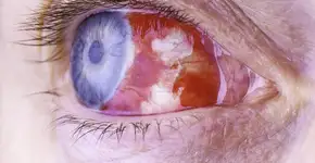 Foto: (sonnydaez/istock)