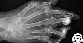 Foto: (Imagem sem texto alternativo disponivel ID [1831258])