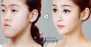 Foto: (Imagem sem texto alternativo disponivel ID [613983])