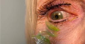 Foto: (reprodução/Instagram/California Eye Associates)