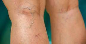 Foto: (iStock/eyepark)