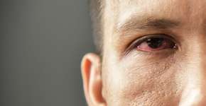 Foto: (eggeeggjiew/istock)