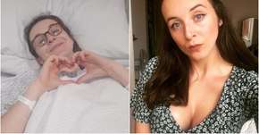 Jovem alerta sobre anticoncepcional após quase morrer