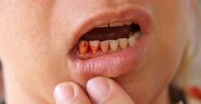 Foto: (iStock/energyy)